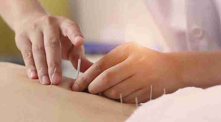 acupuncture in digbeth sheldon